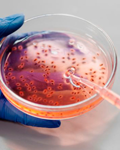 Hematología