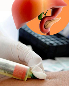 Hematología