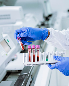 Hematología